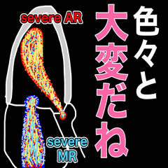 令和の究極心エコー